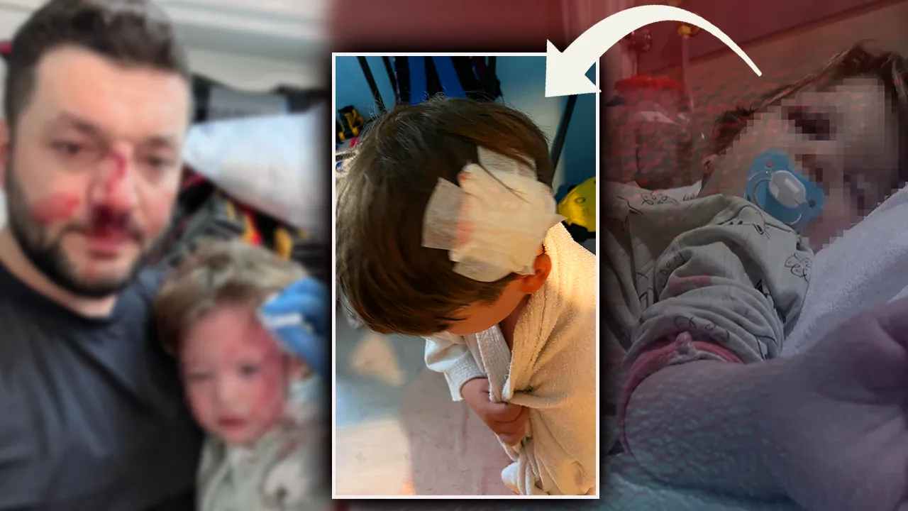 Yalova’daki ‘komşu’ dehşetinde şüpheli olay! 14 aylık İkra’dan sonra ağabeyi de saldırıya uğradı 