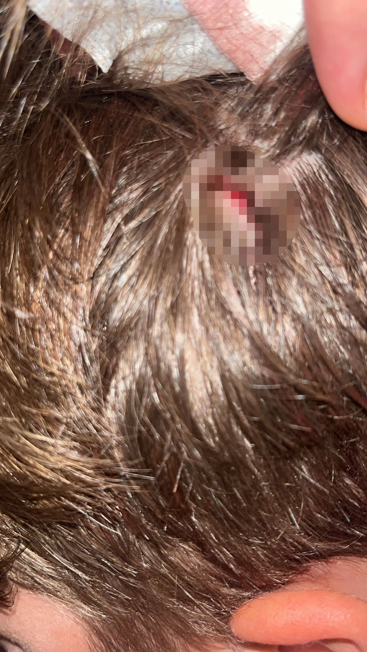 Yalova’daki ‘komşu’ dehşetinde şüpheli olay! 14 aylık İkra’dan sonra ağabeyi de saldırıya uğradı