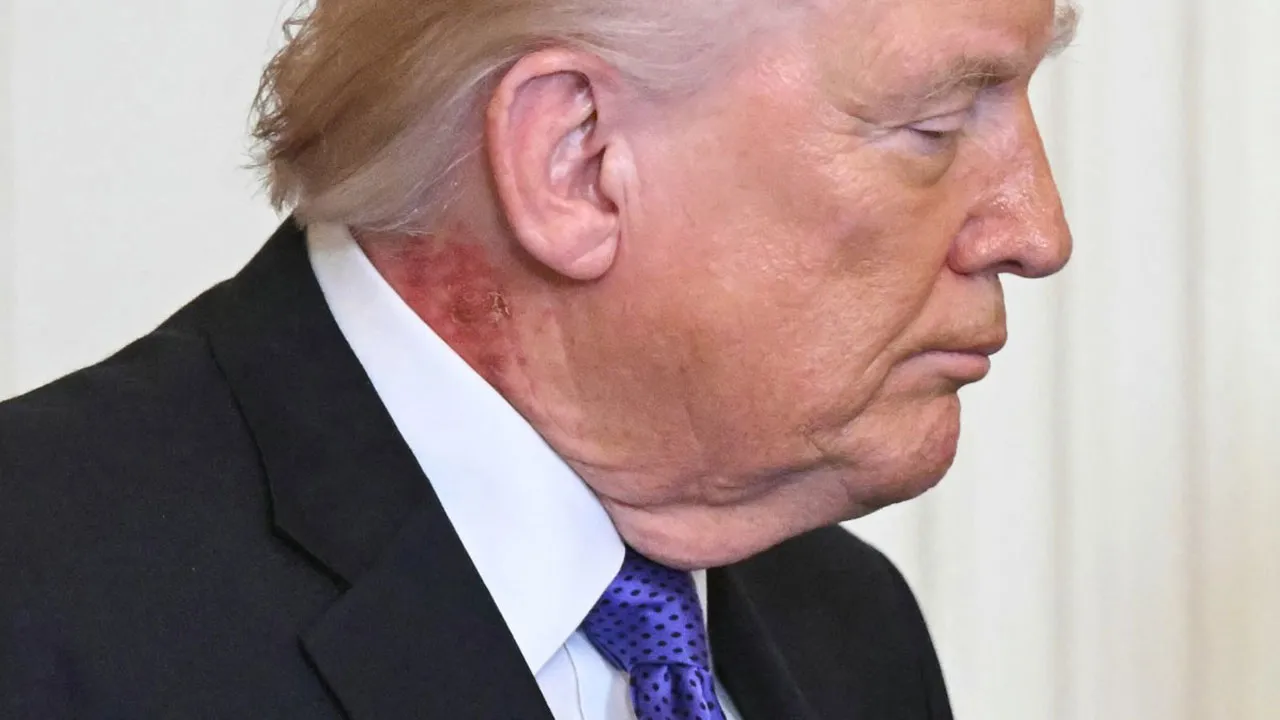 BOYNUNDA GİZEMLİ KIZARIKLIK!