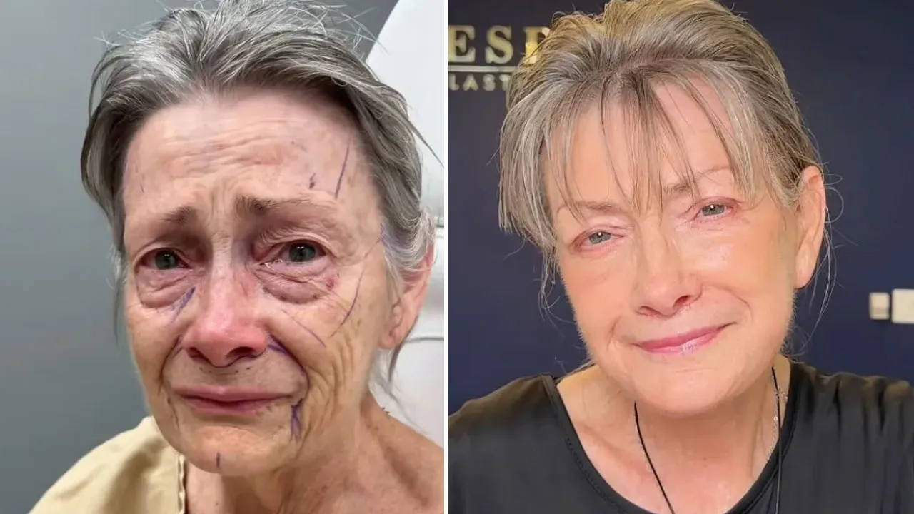 Estetik ameliyat harikası! 70 yaşındaki kadının inanılmaz dönüşümü