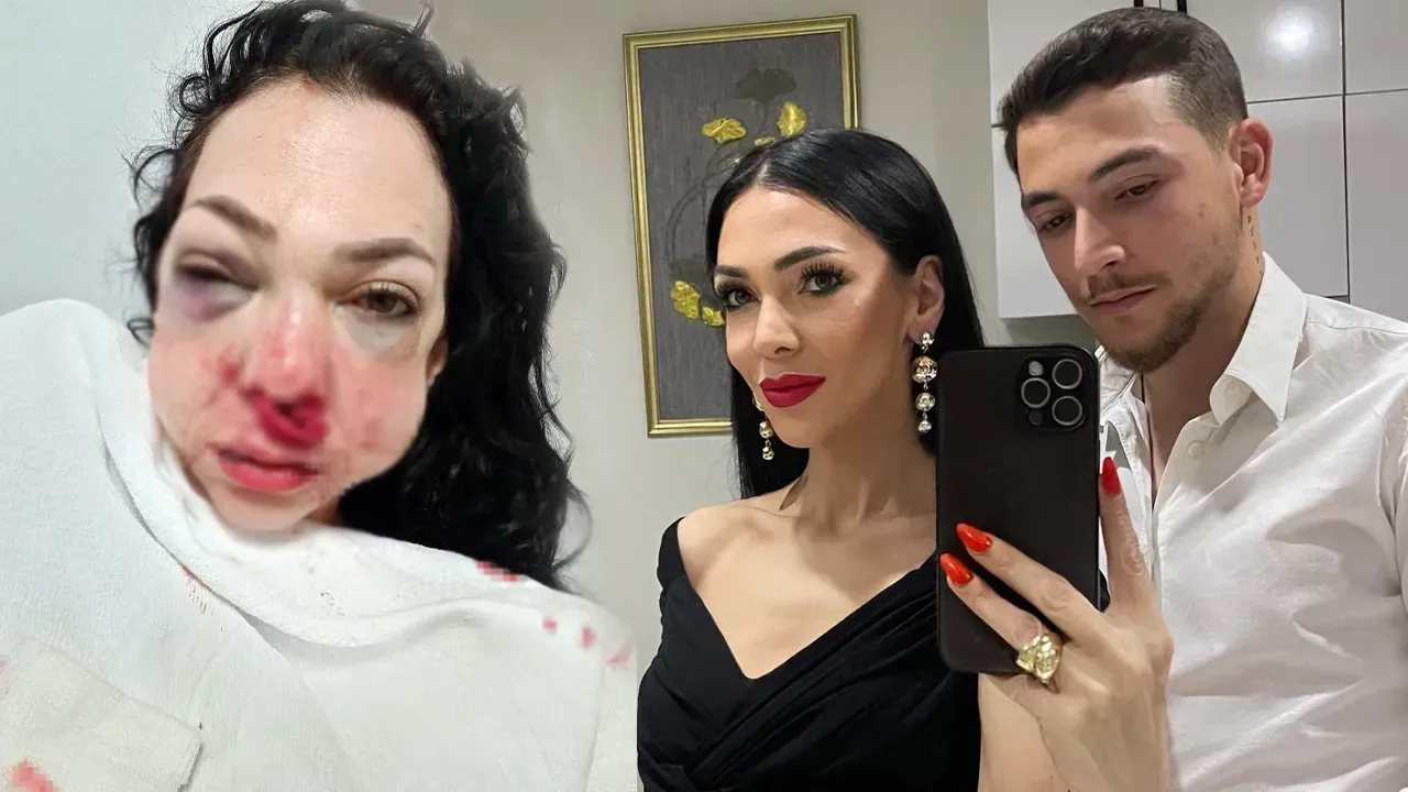 SEBEBİ PES DEDİRTTİ