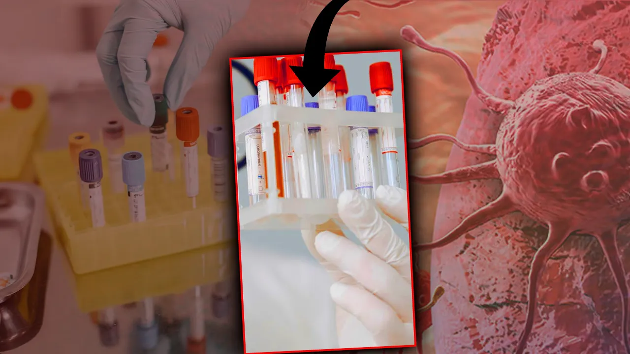 Ölümcül ‘yaşlı’ hastalığı gençleşti! Vaka yaşı 50’nin altına düştü 