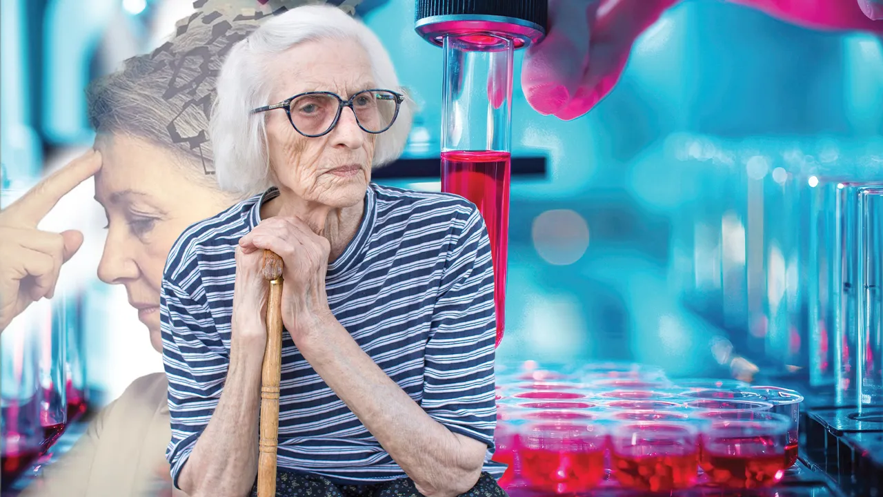 Unutkanlık riskini 20 yıl önceden bileceğiz: Bir tüp kandan alzaymıra erken teşhis