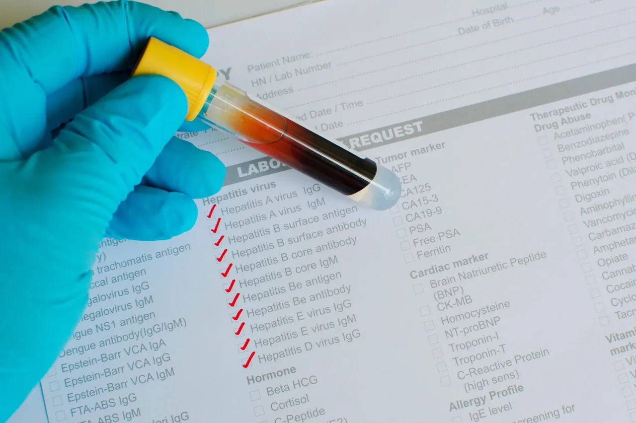 Sessiz tehlikeye karşı 6 altın kural! Karaciğeriniz “imdat” demeden tedbirinizi alın