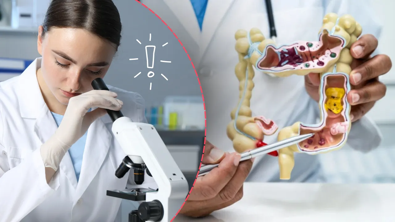 Bu kanser artık gençler arasında artış gösteriyor! Uzmanlar erken teşhis çağrısı yaptı 