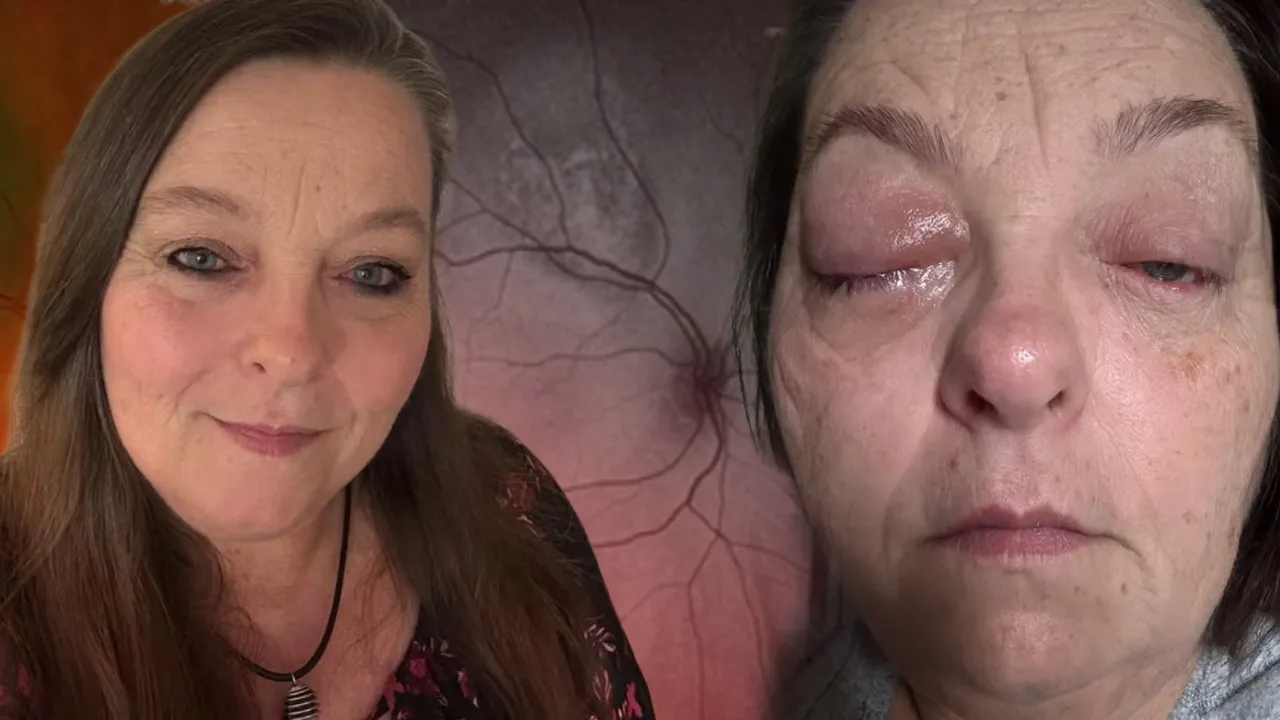 Çay yaparken gözünde beliren siyah nokta alarm verdi! Korkunç gerçek çok geçmeden ortaya çıktı