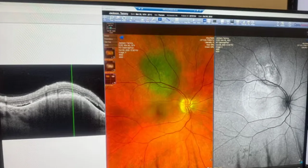 Çay yaparken gözünde beliren siyah nokta alarm verdi! Korkunç gerçek çok geçmeden ortaya çıktı