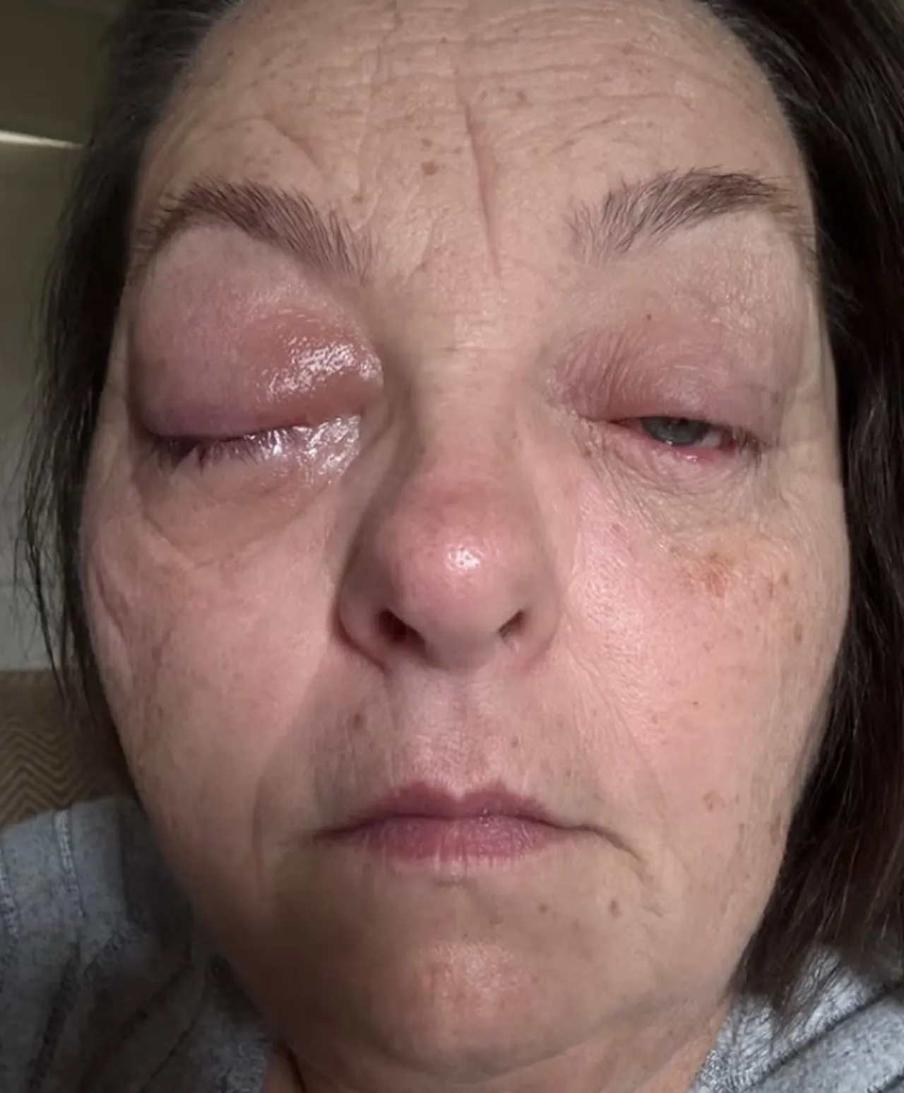 Çay yaparken gözünde beliren siyah nokta alarm verdi! Korkunç gerçek çok geçmeden ortaya çıktı