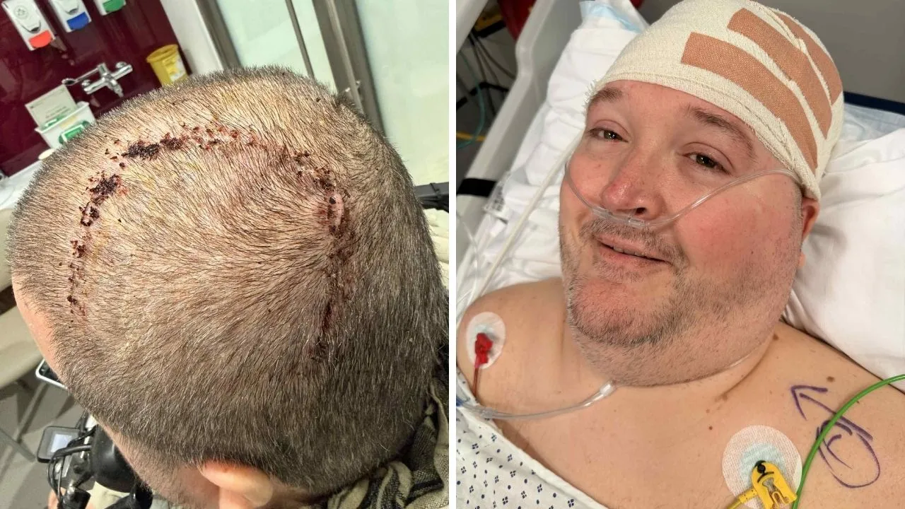 Neuralink hastası beyin çipiyle World of Warcraft oynamaya başladı