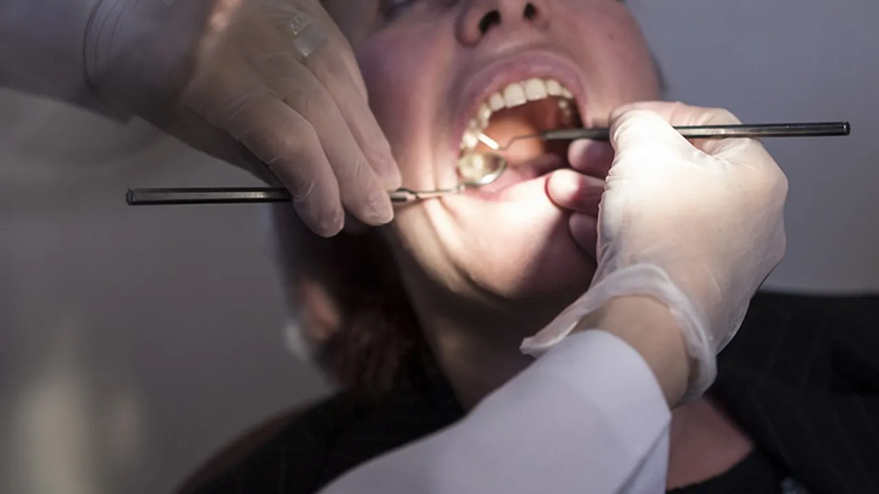 Uzman isim uyardı: Sağlam amalgam dolgulara dokunmayın!