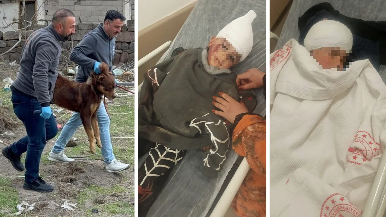 Başıboş sokak köpeği küçük çocuğa saldırdı! 3 ameliyat oldu, acılı aile isyanda