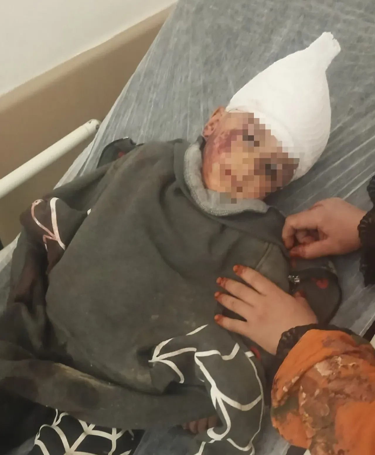 Başıboş sokak köpeği küçük çocuğa saldırdı! 3 ameliyat oldu, acılı aile isyanda