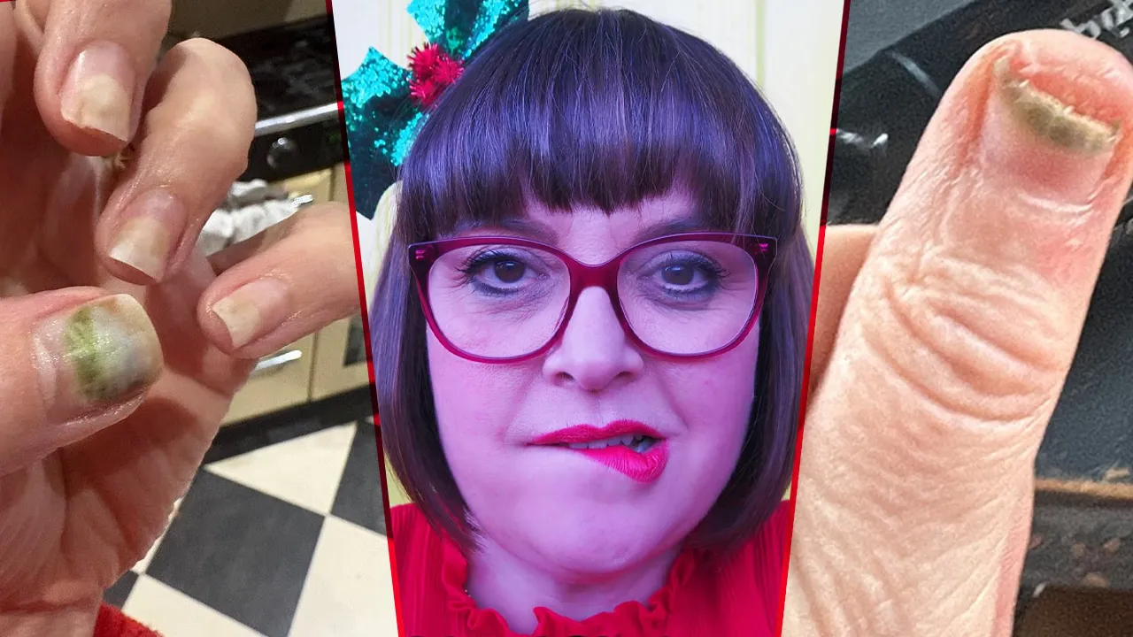 Yaptırdığı manikür sonrası tırnakları yeşile döndü, kötü koku yayıldı! Kabus tam 2 ay sürdü