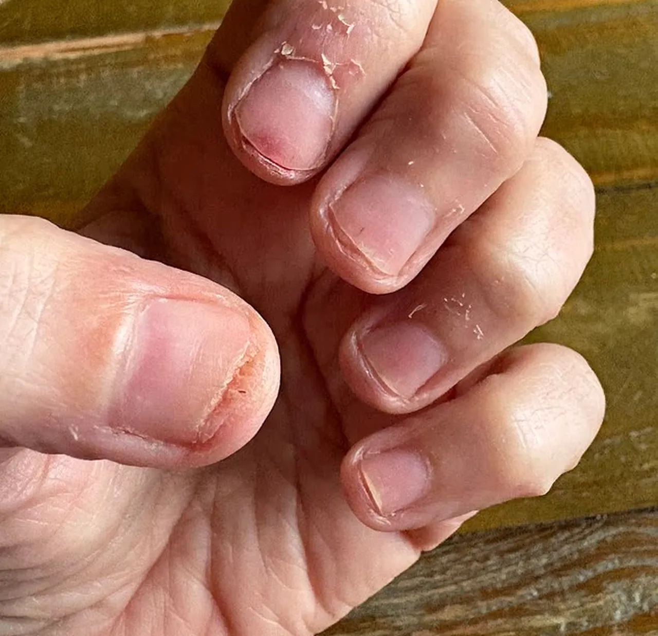 Yaptırdığı manikür sonrası tırnakları yeşile döndü, kötü koku yayıldı! Kabus tam 2 ay sürdü