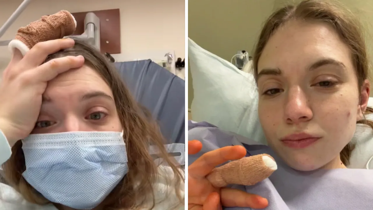 Tırnak yeme alışkanlığı kabusa dönüştü: Parmağını kaybetmekten son anda kurtuldu