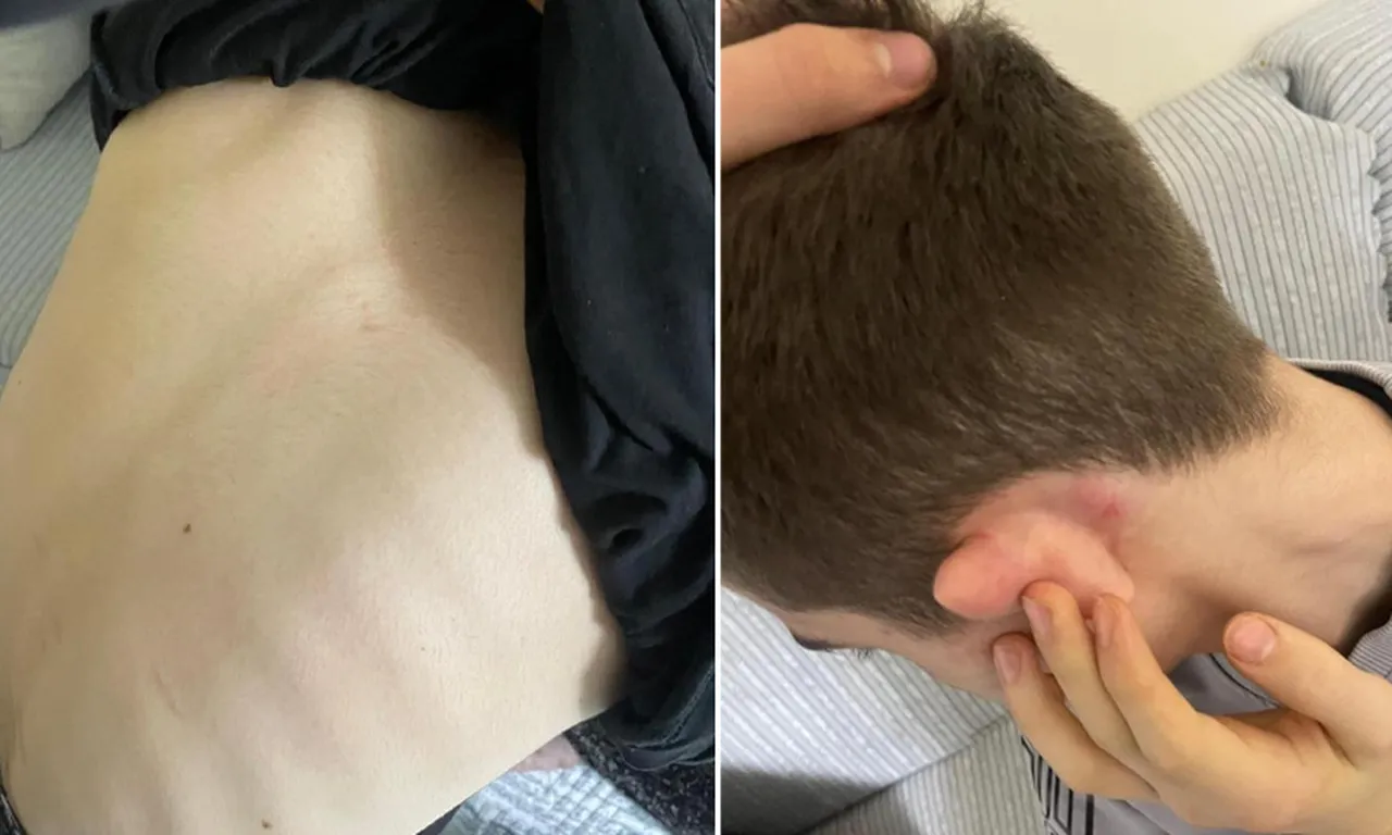 14 yaşındaki çocuğa tekme tokat saldırı! Kuryeler yapmadığını bırakmadı