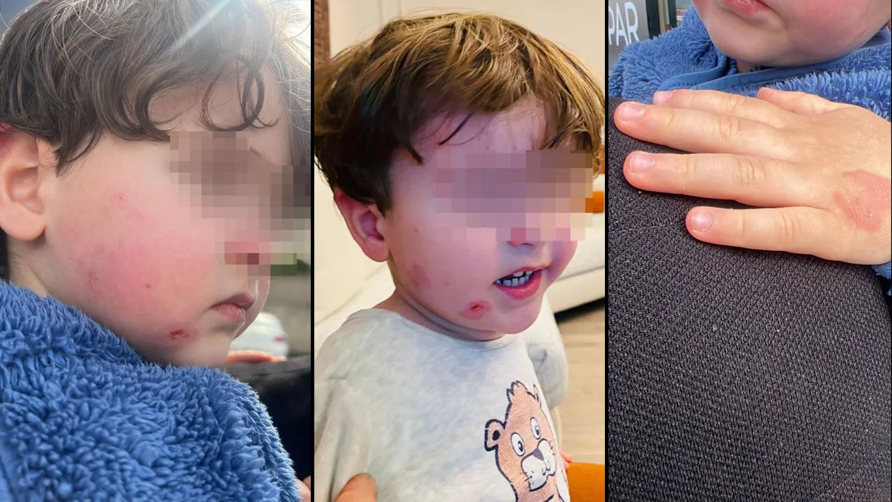 2,5 yaşındaki çocuğa kreşte darp! '2 dakika' savunması şoke etti