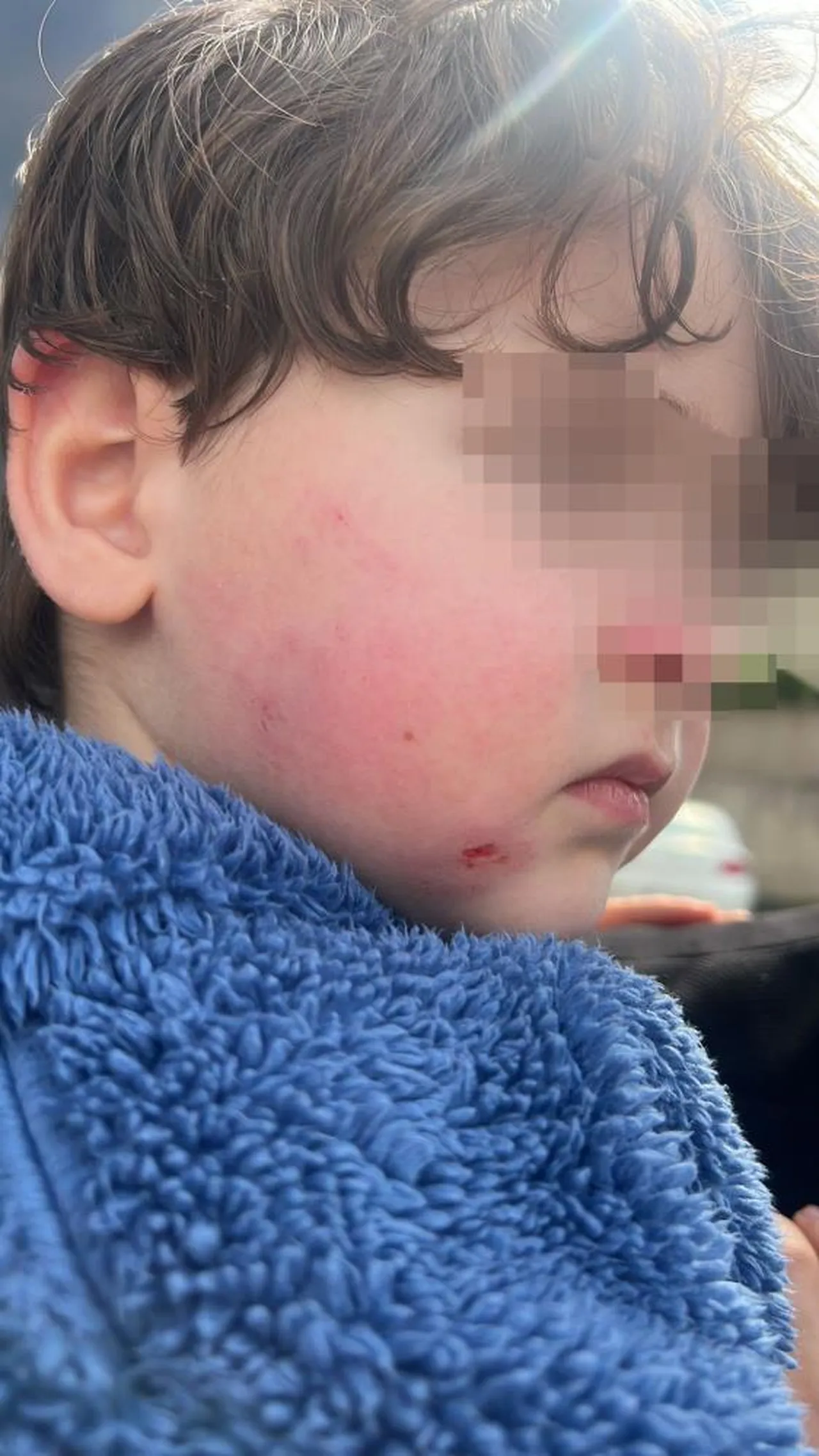 2,5 yaşındaki çocuğa kreşte darp! '2 dakika' savunması şoke etti