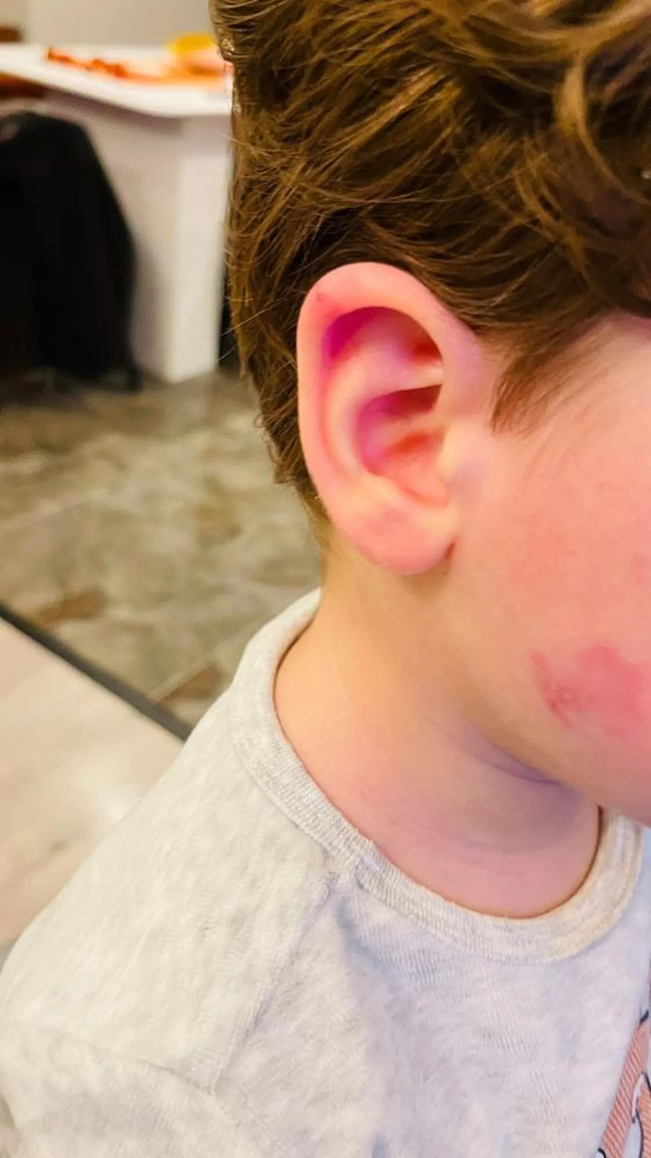 2,5 yaşındaki çocuğa kreşte darp! '2 dakika' savunması şoke etti