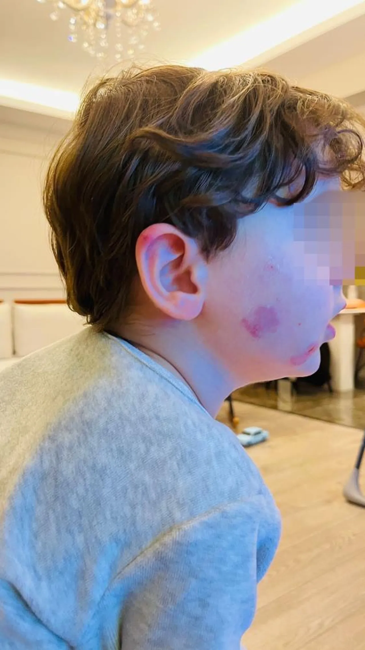 2,5 yaşındaki çocuğa kreşte darp! '2 dakika' savunması şoke etti