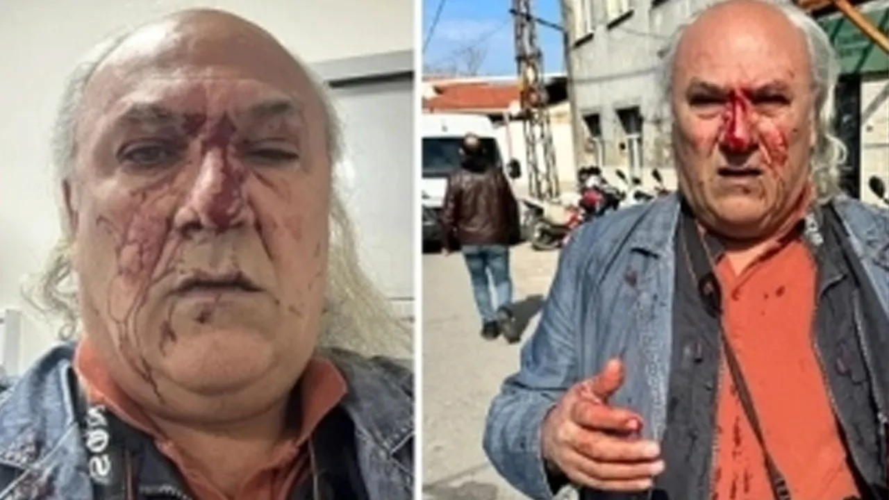 CHP'yi haber yaptı tekme tokat dövüldü! Belediye koruması, 7 kişiyle birlikte saldırdı