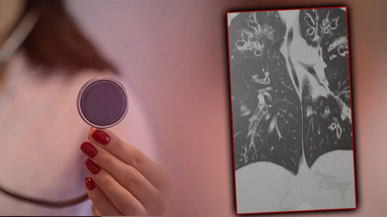  Dünyada en çok öldüren 4'üncü hastalık! 65 yaş üstü risk altında, akciğeri parçalıyor 