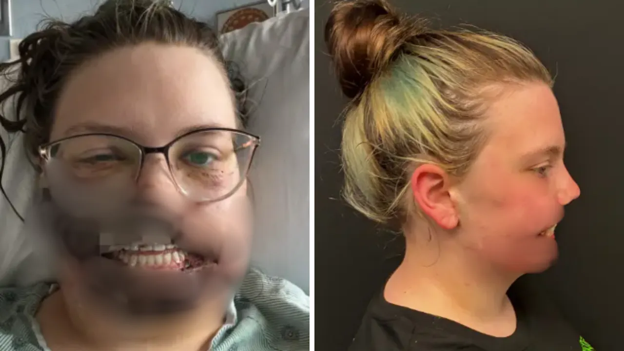 Köpeği dehşeti yaşattı! Nöbet geçirdiği sırada saldırdı, yüzünü parçaladı 