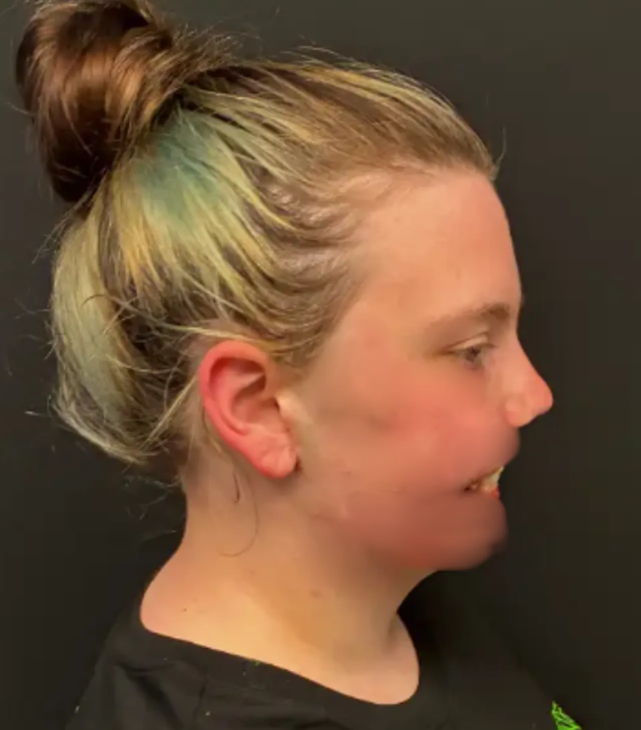 Köpeği dehşeti yaşattı! Nöbet geçirdiği sırada saldırdı, yüzünü parçaladı