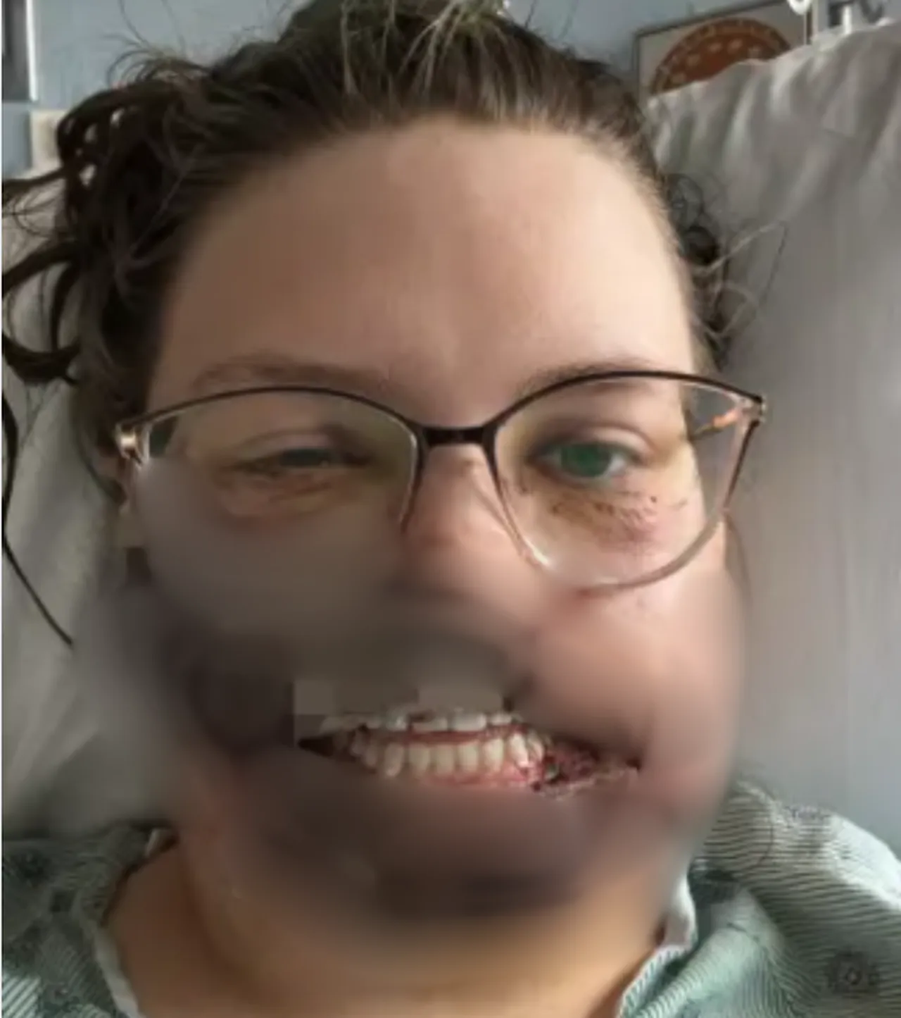 Köpeği dehşeti yaşattı! Nöbet geçirdiği sırada saldırdı, yüzünü parçaladı