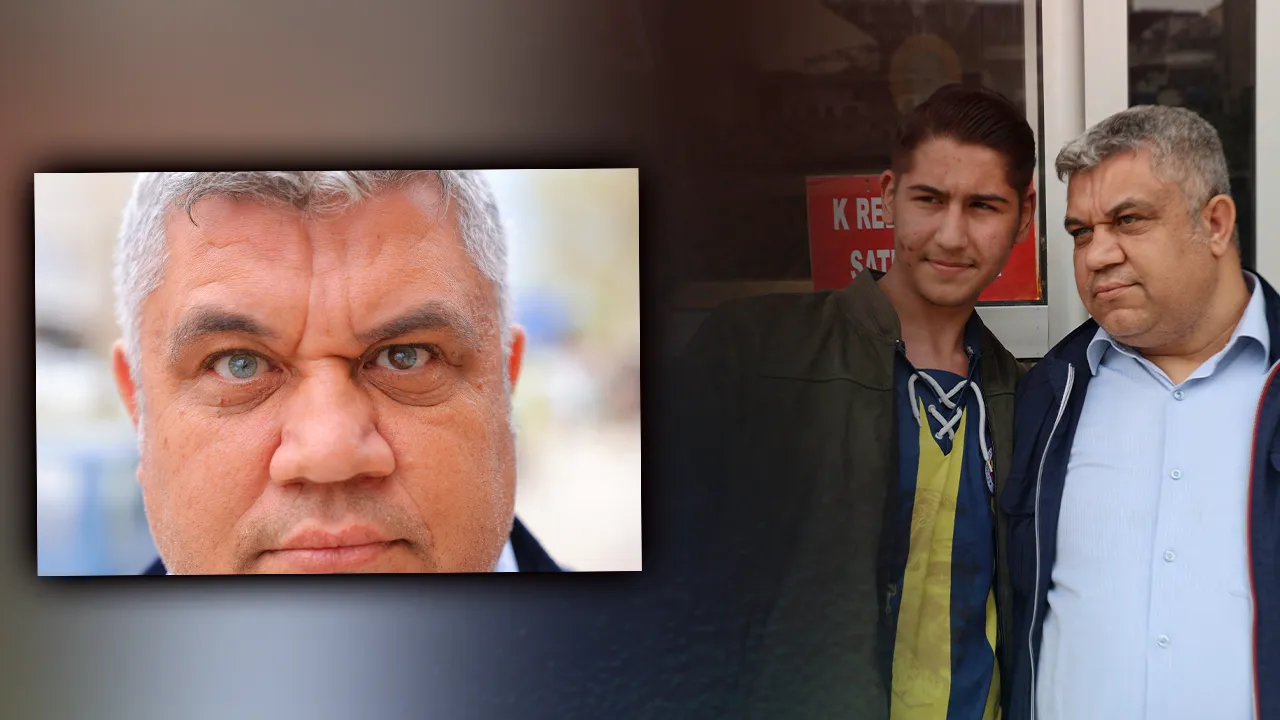 Gören fotoğraf çektiriyor! Gözleri 3 renk, hikayesi herkesi şaşırttı