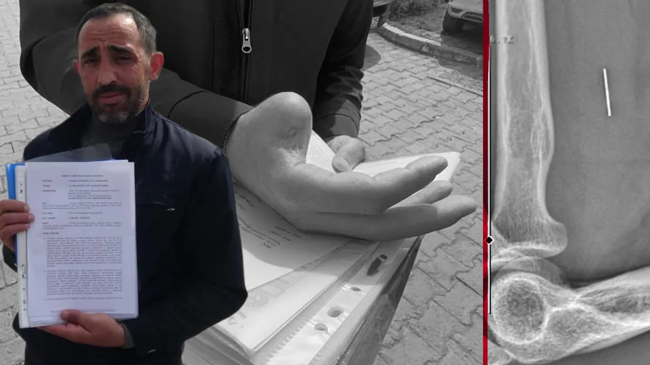 Basit bir bıçak kesiği hayatını kabusa çevirdi! Önce çürüdü sonra parmağını kaybetti