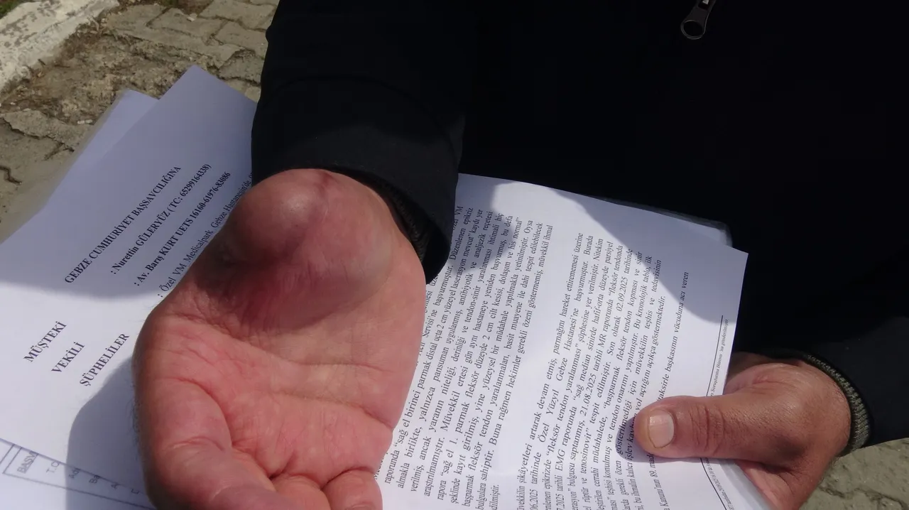 Basit bir bıçak kesiği hayatını kabusa çevirdi! Önce çürüdü sonra parmağını kaybetti