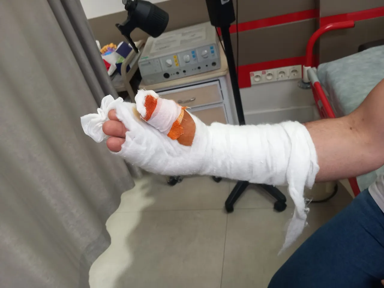 Basit bir bıçak kesiği hayatını kabusa çevirdi! Önce çürüdü sonra parmağını kaybetti