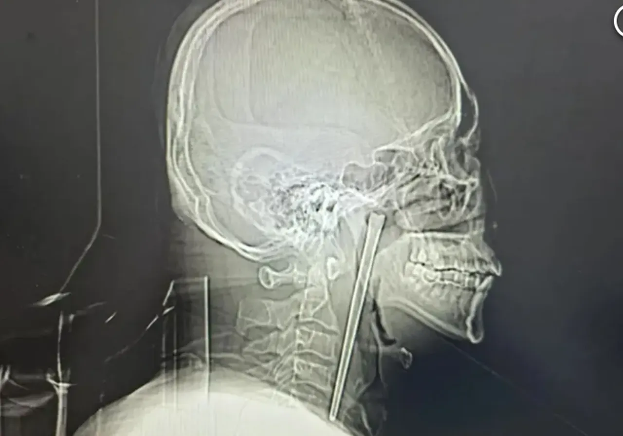 Kaynak: CTS News/YouTube