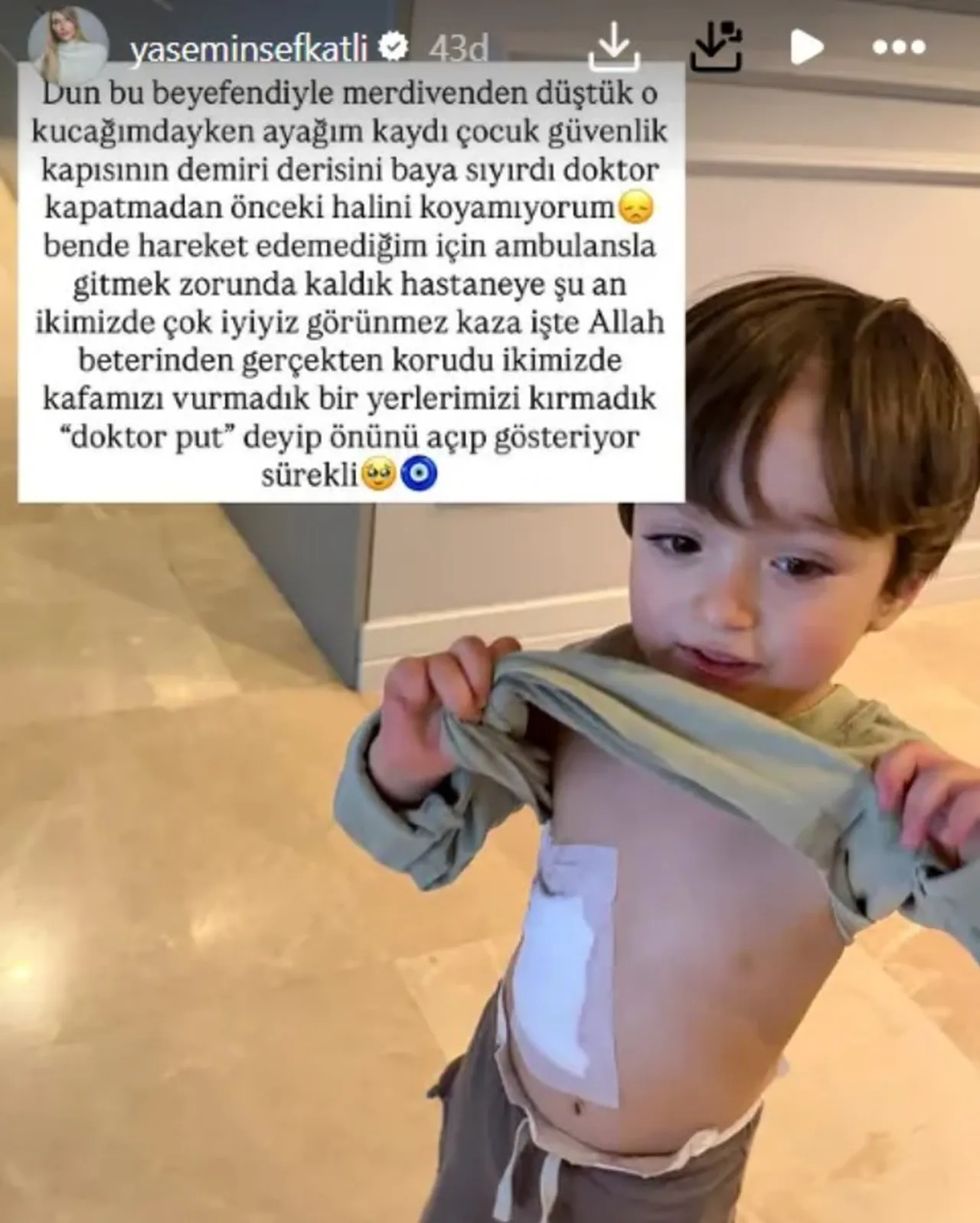 Tatlıses ailesinden bir korkutan haber daha! Anne oğul merdivenlerden düştü
