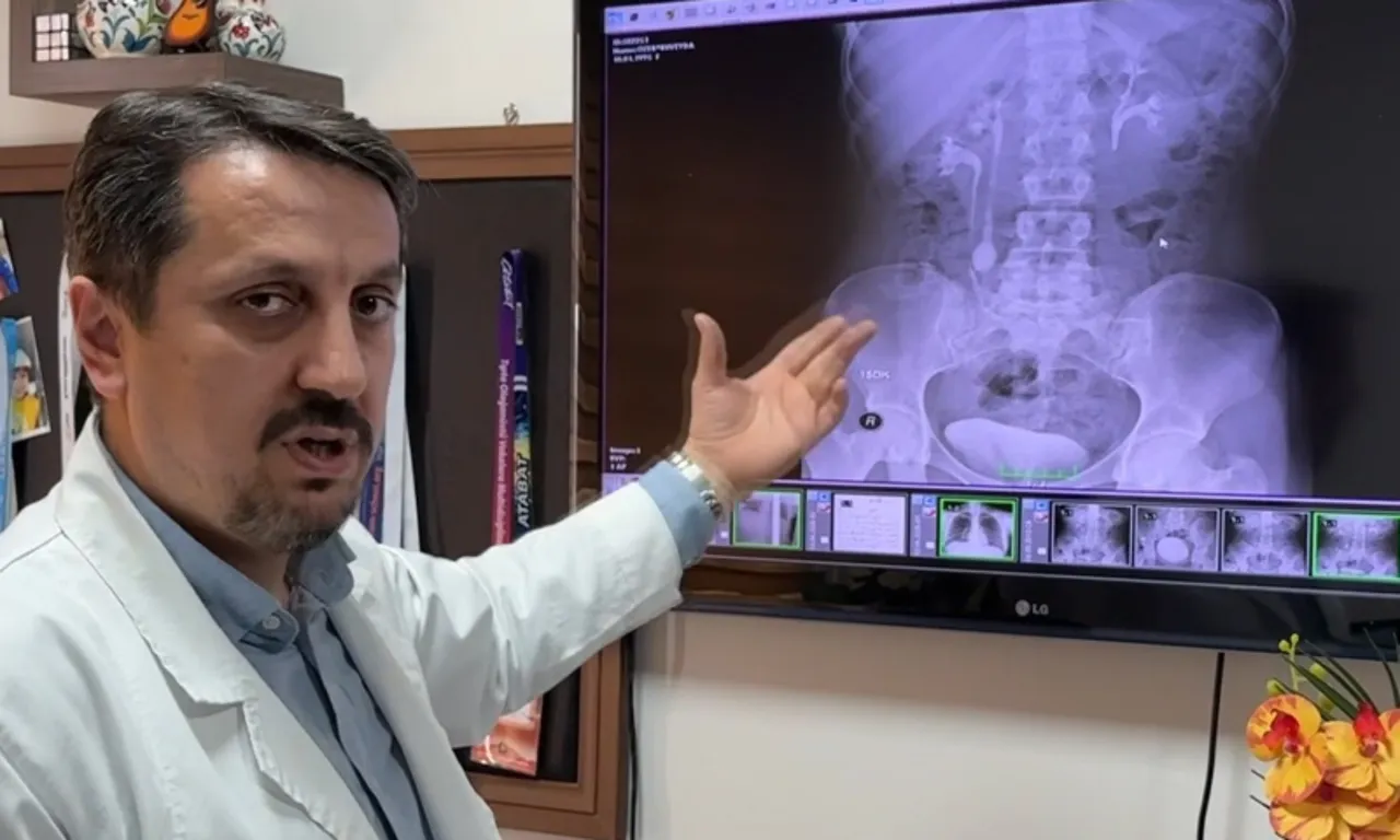 Dayanılmaz ağrıyla her gün acile gidiyordu! Gerçek sebep ameliyatta ortaya çıktı