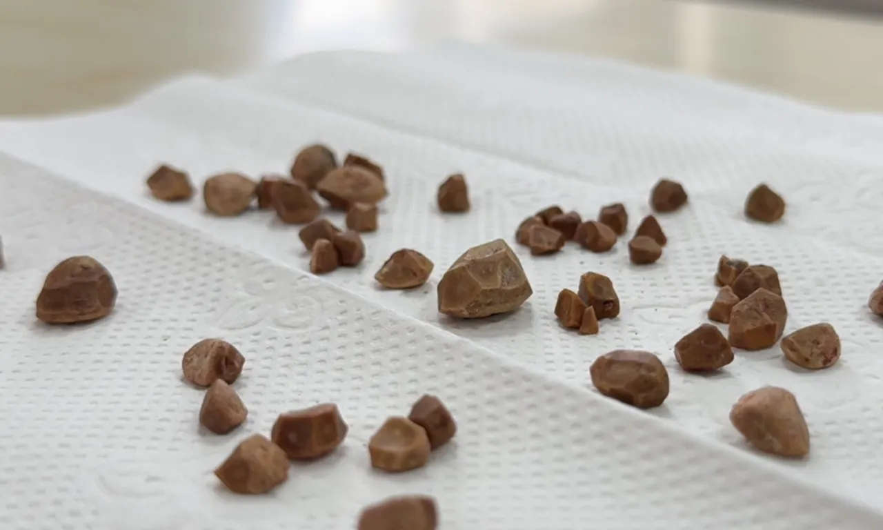 Dayanılmaz ağrıyla her gün acile gidiyordu! Gerçek sebep ameliyatta ortaya çıktı