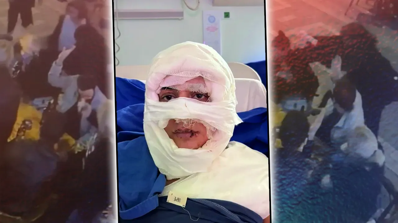 İstanbul’un göbeği Kadıköy'deki kolonyalı dehşette ‘Pes’ dedirten savunma: Orada saçlarını yakma istediği doğdu