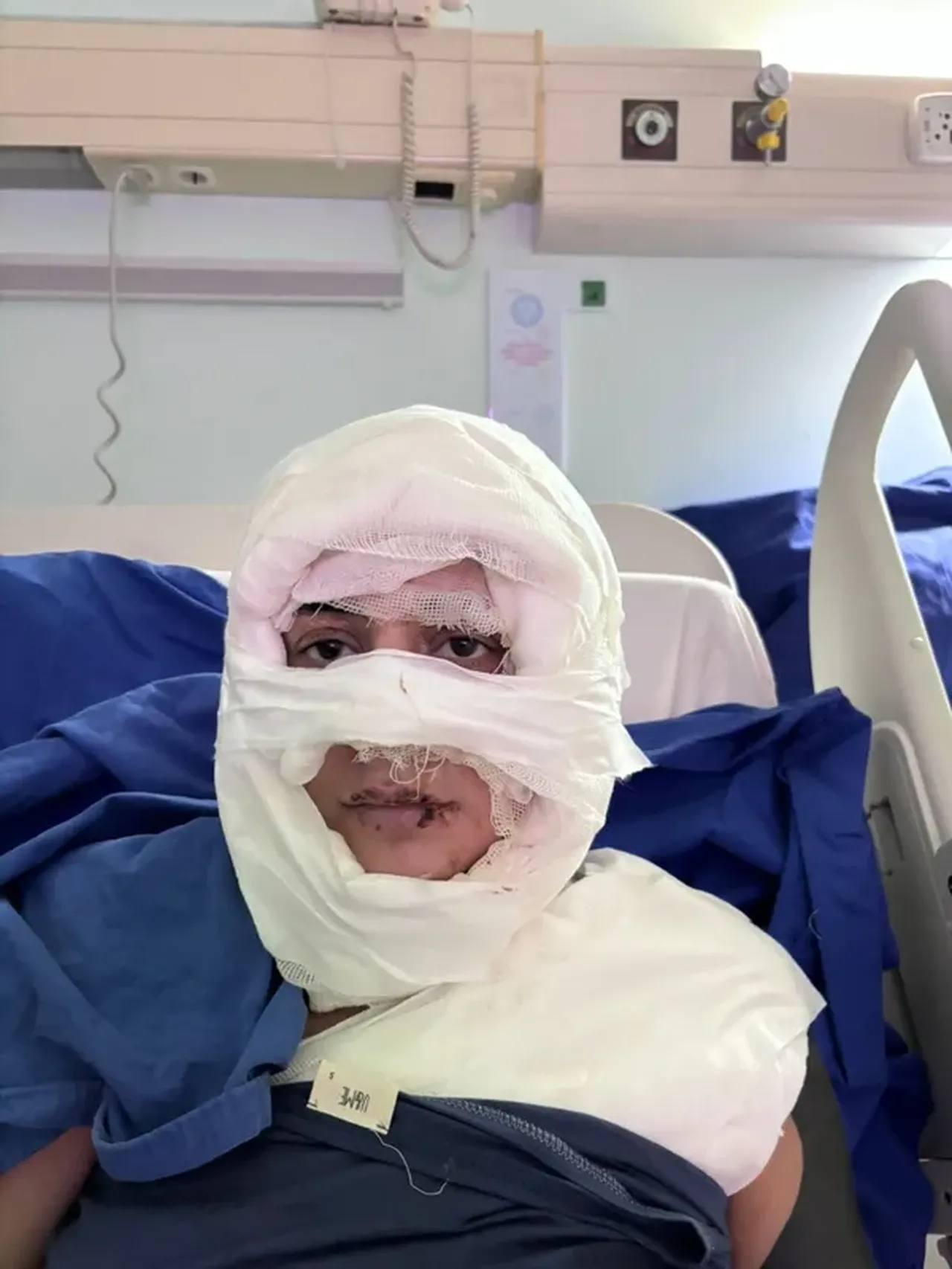 İstanbul’un göbeği Kadıköydeki kolonyalı dehşette ‘Pes’ dedirten savunma: Orada saçlarını yakma istediği doğdu