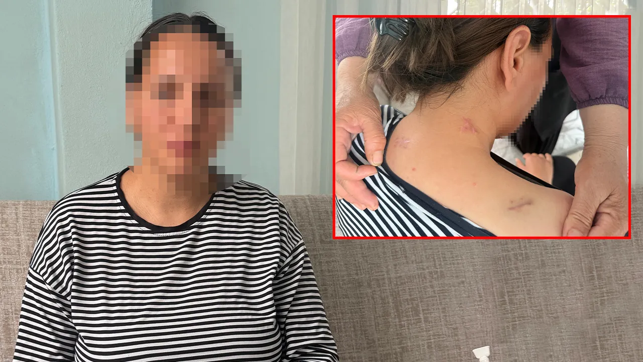 17 yerinden bıçaklandı, ölü taklidi yaparak kurtuldu! 