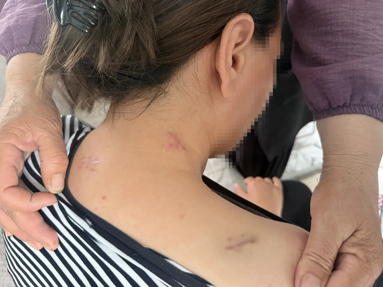 17 yerinden bıçaklandı, ölü taklidi yaparak kurtuldu! "Gidip cesedini alın" demiş