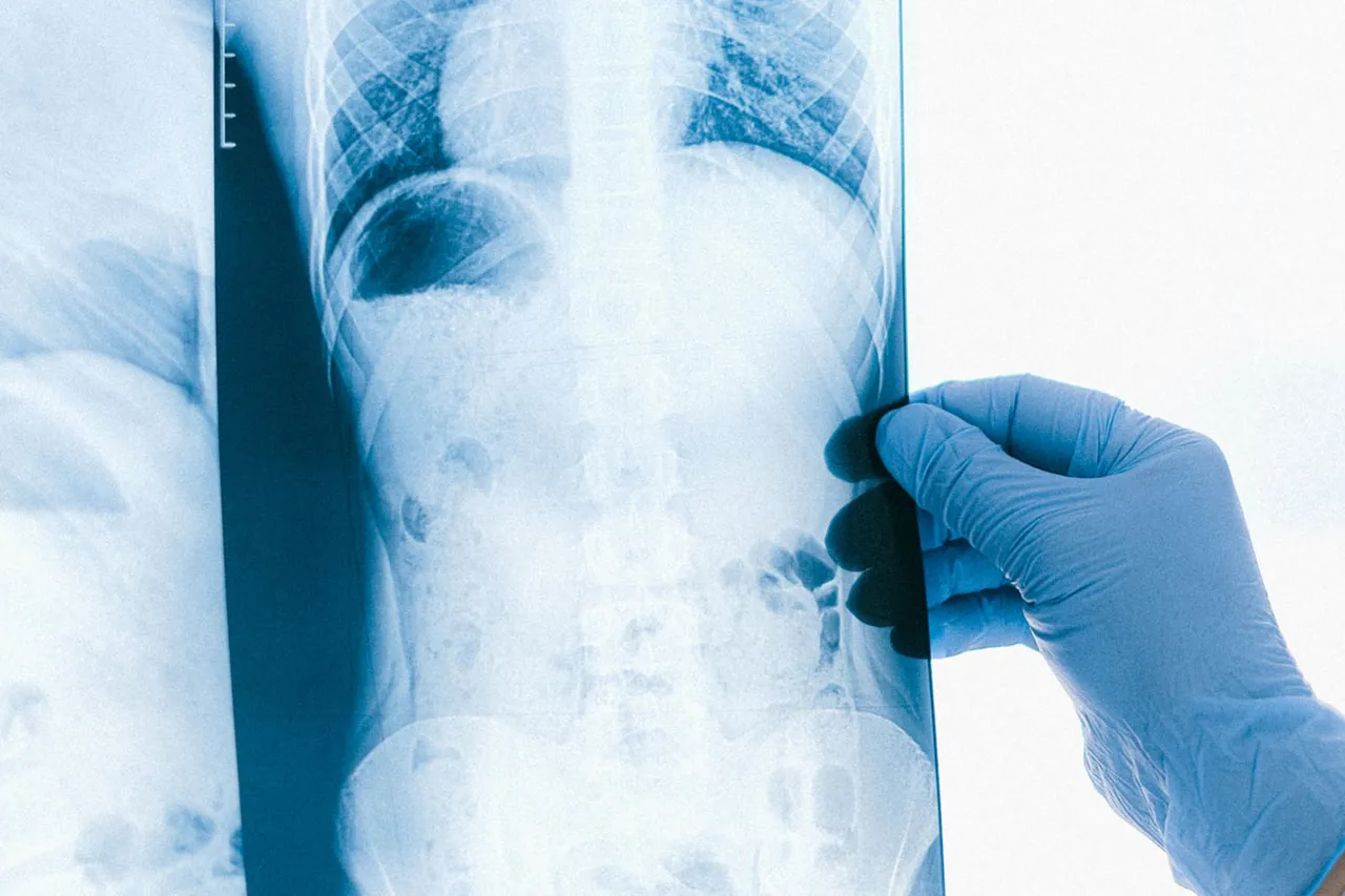 Milyonda 7 kişide görülen hastalık! Göğüs ağrısı diye gitti, gerçek başka çıktı