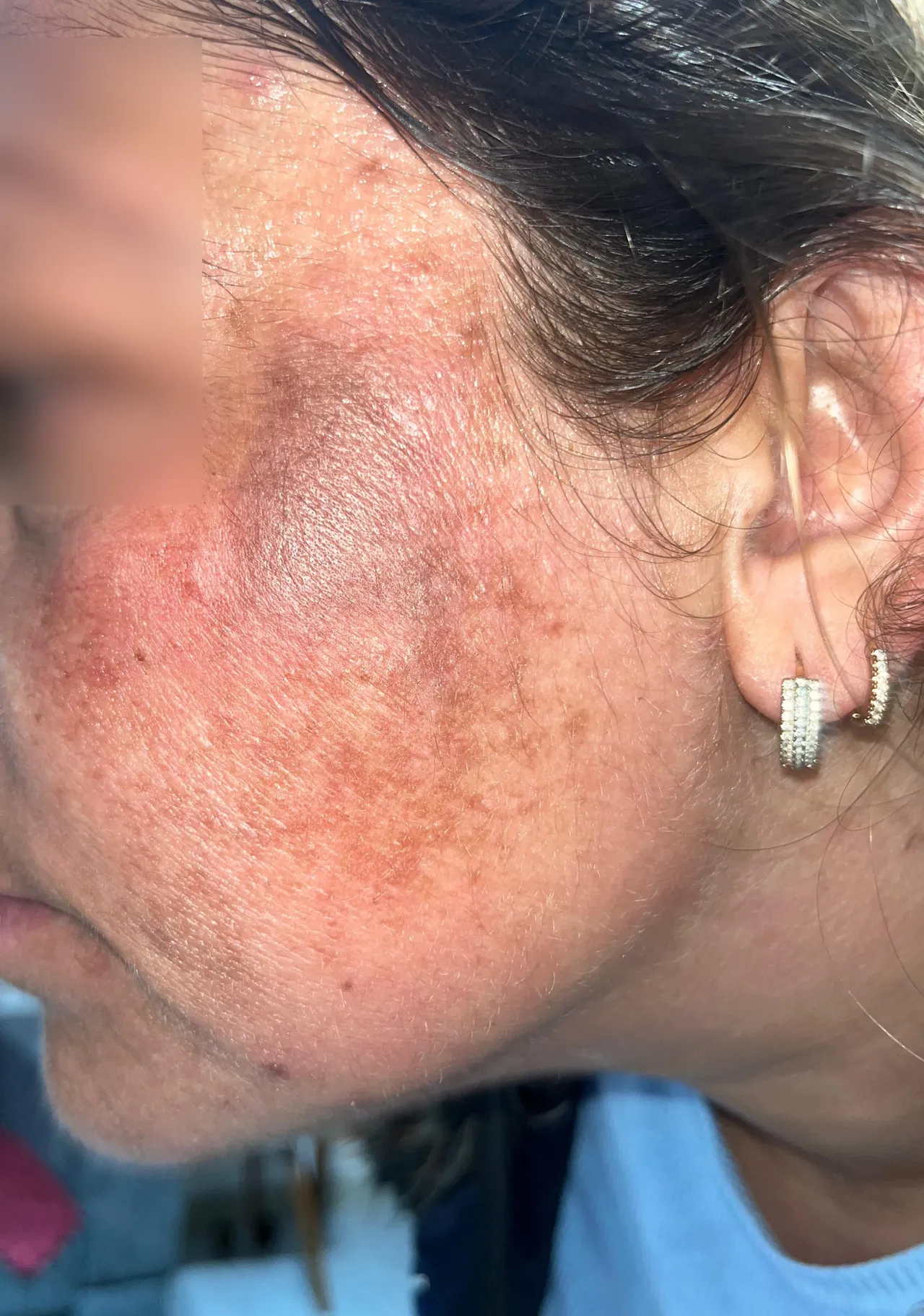 ‘Prenses paketi’ kabusa döndü! “Çocuğum görünce ‘öcü’ diyerek kaçtı”