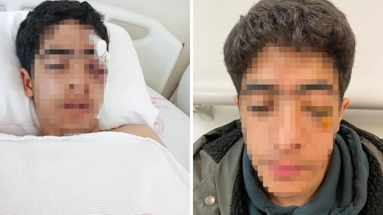 15 yaşındaki çocuğa muştayla feci dayak!