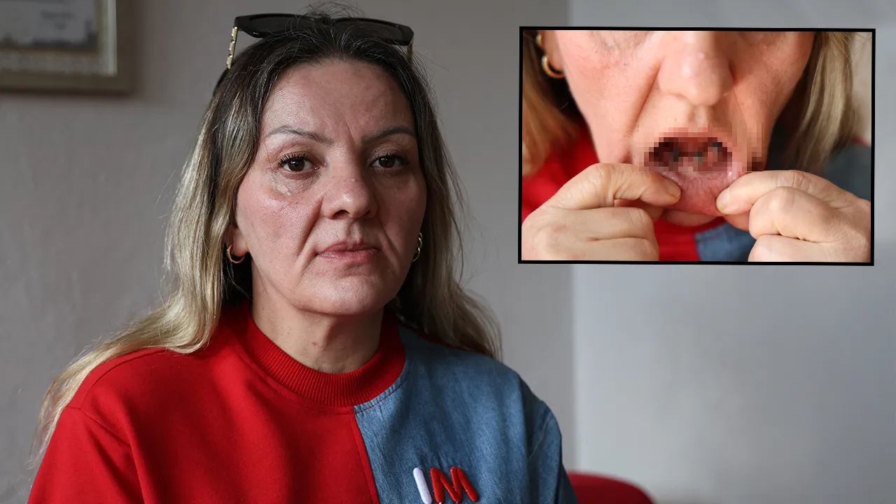 Diş ağrısıyla gitti, 25 dişini birden çektiler! Hayatı karardı