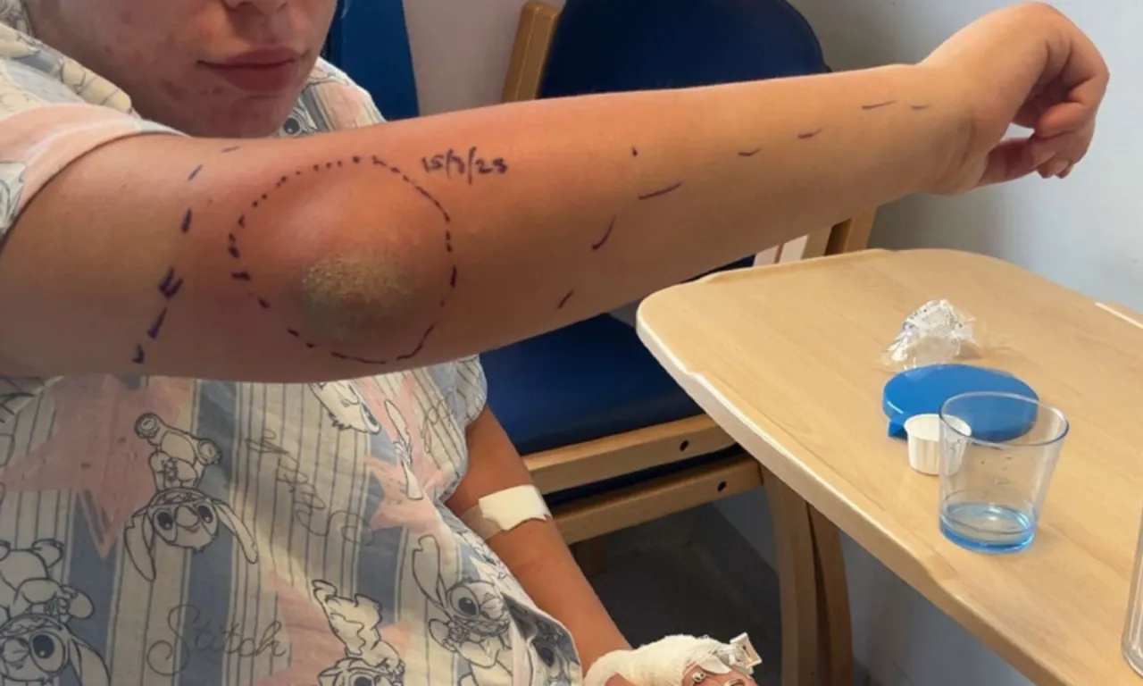 Basit bir sırt ağrısı sandı, bıçak saplanır gibi acıya dönüştü! Gerçek ortaya çıktı