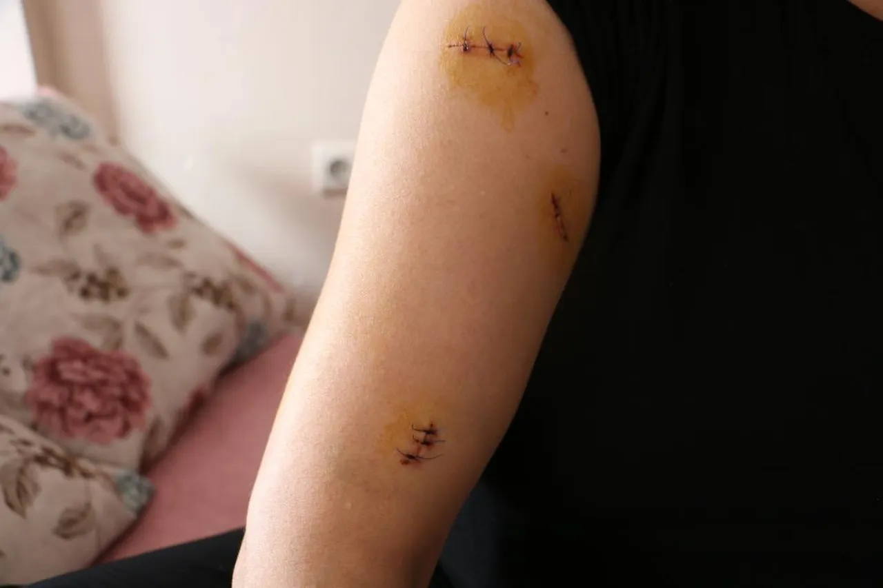 Dini nikahlı eşi dehşeti yaşattı! 30 yerinden bıçakladı