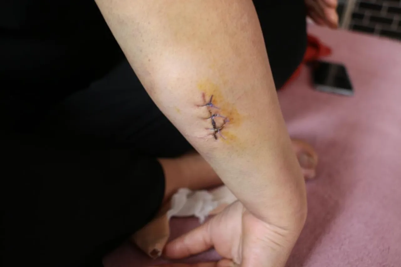 Dini nikahlı eşi dehşeti yaşattı! 30 yerinden bıçakladı