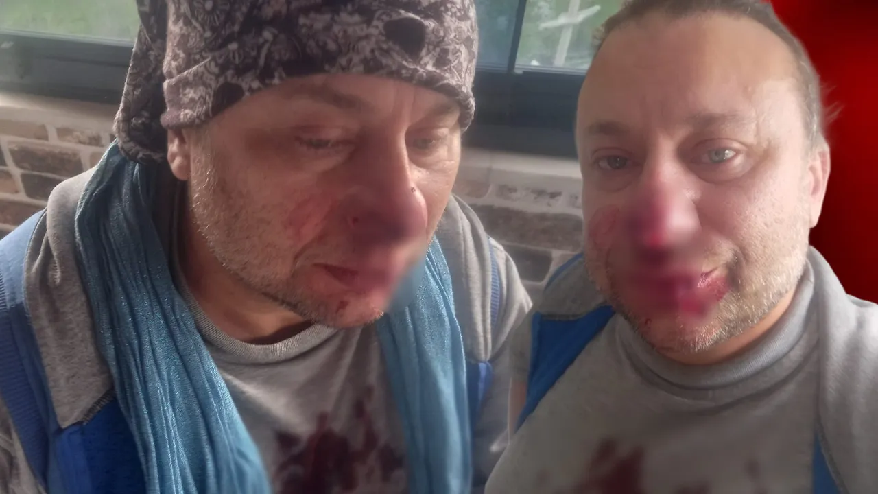 Pitbull saldırısına uğrayan Onur Akay yoğun bakımdan çıktı: Ölümden döndüm