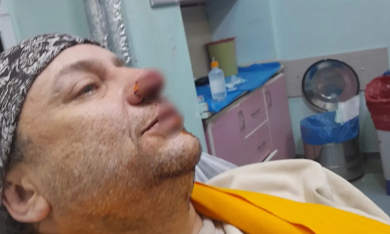 Pitbull saldırısına uğrayan Onur Akay yoğun bakımdan çıktı: Ölümden döndüm